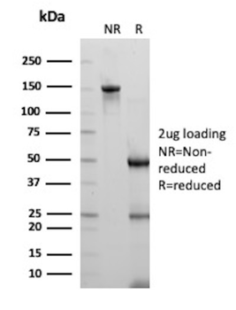 HPV-18 (Human Papilloma Virus 18) Antibody