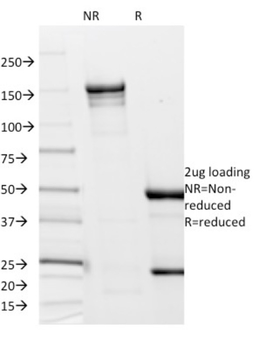 Borrelia burgdorferi (p41 Flagellin) Antibody