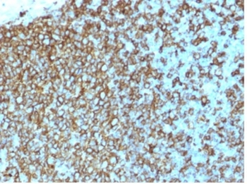 HLA-DPB1 Antibody