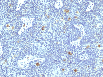 HPV-16 (Human Papilloma Virus 16) Antibody