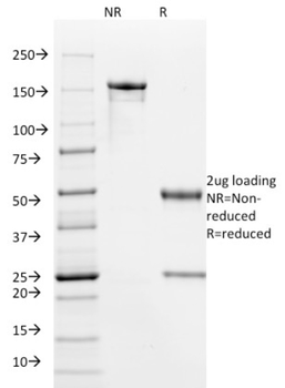 HPV-16 (Human Papilloma Virus 16) Antibody