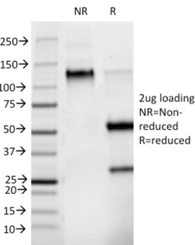 Phosphotyrosine (P-Tyr) Antibody