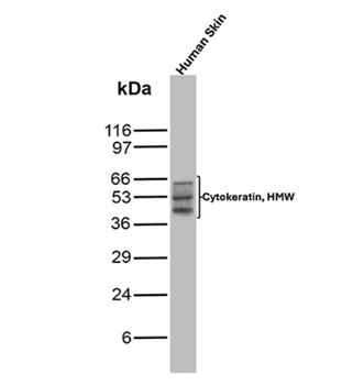 KRT76 Antibody