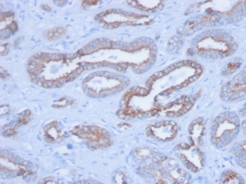 Cytokeratin, pan (Epithelial Marker) Antibody