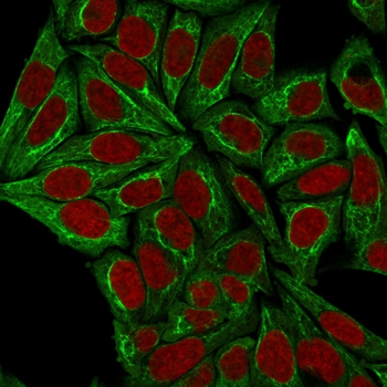 Cytokeratin, pan (Epithelial Marker) Antibody