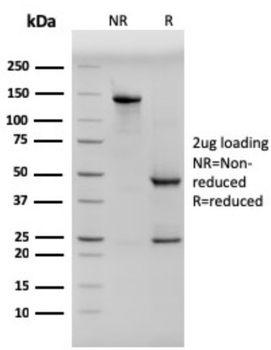 Cytokeratin, pan (Epithelial Marker) Antibody