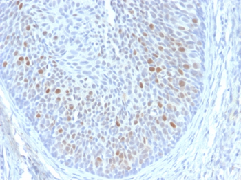 E1^E4 Antibody