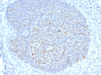 E1^E4 Antibody
