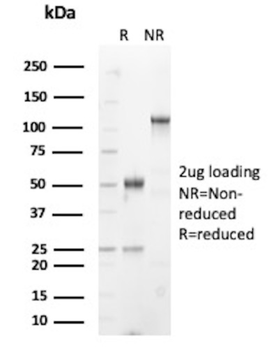 HLA-DPB1 Antibody