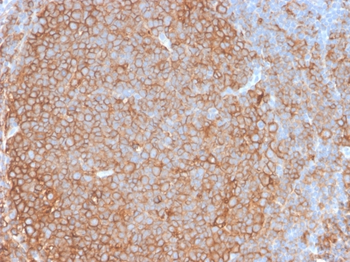 HLA-DPB1 Antibody