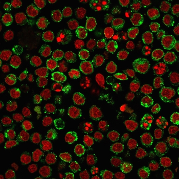 HLA-DPB1 Antibody