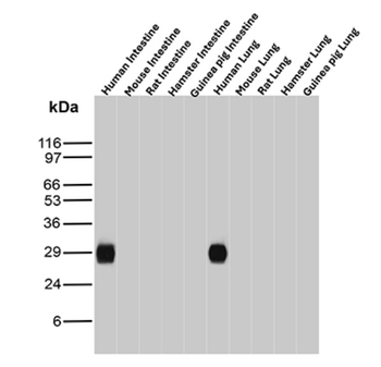 HLA-DPB1 Antibody