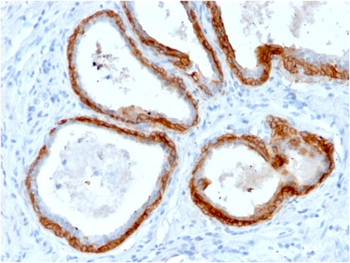KRT76 Antibody
