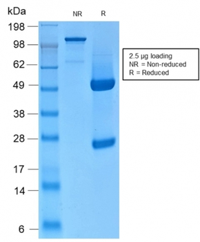 KRT76 Antibody