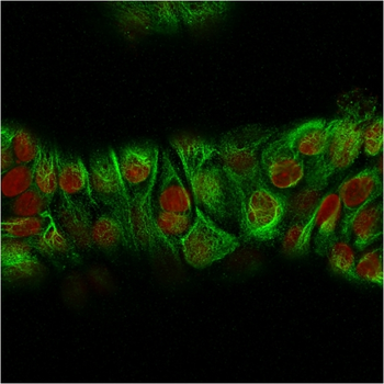 KRT76 Antibody