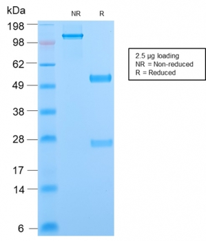 Recombinant Phosphotyrosine (P-Tyr) Antibody