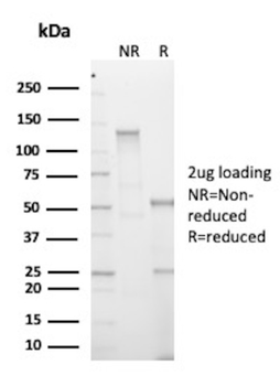 Recombinant Phosphotyrosine (P-Tyr) Antibody