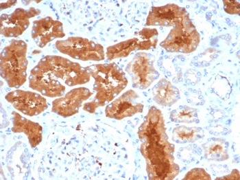 DAXX Antibody
