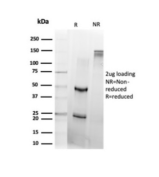 DAXX Antibody
