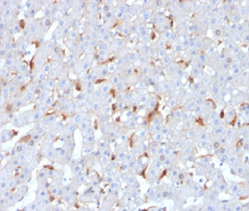 C1QB Antibody