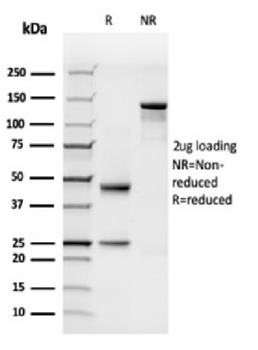 C1QB Antibody