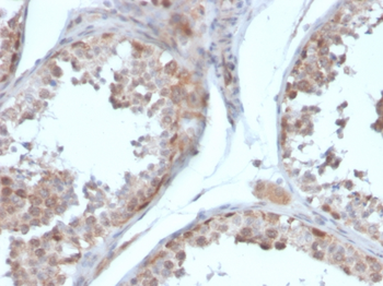 FST Antibody