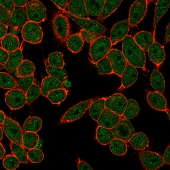 FOSL2 Antibody