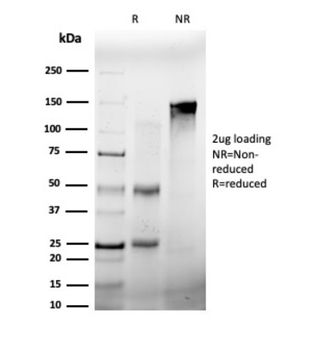 FOSL2 Antibody