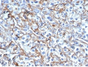 ICAM1 Antibody