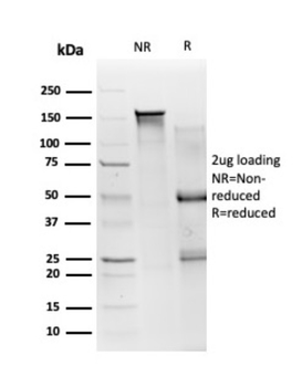 SMAD3 Antibody