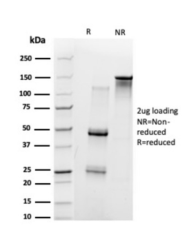 UBE3A Antibody