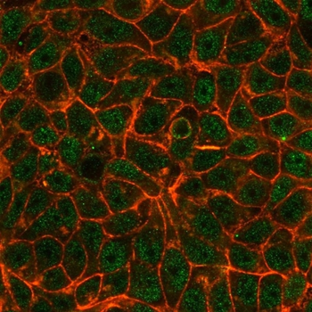 TRIM24 Antibody