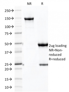 Ksp-Cadherin / CDH16 (Renal Cell Marker) Antibody