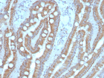 CEACAM5 Antibody