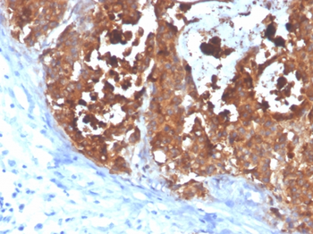CEACAM5 Antibody