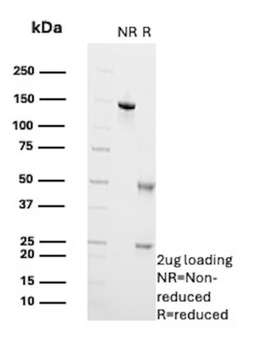 CEACAM5 Antibody