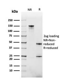 TNFRSF13C Antibody