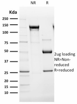 ENG Antibody