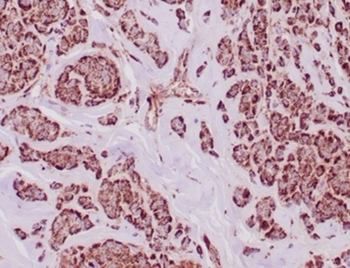 ALDH1A1 Antibody
