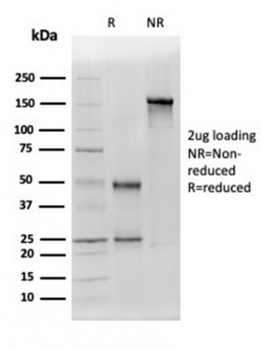 ALDH1A1 Antibody