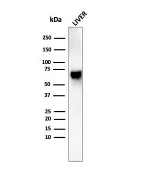 ALB Antibody