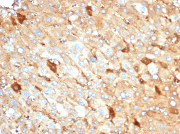 ALB Antibody