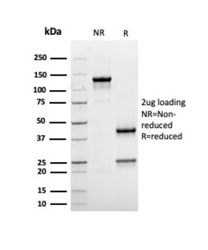 ALB Antibody