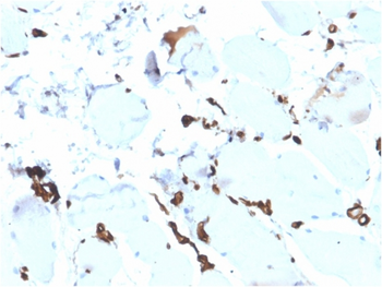 FABP5 Antibody