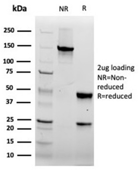 FABP5 Antibody