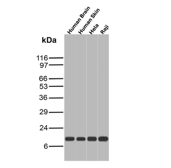 FABP5 Antibody