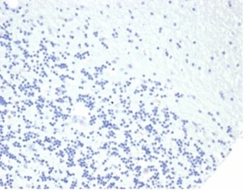 GH1 Antibody