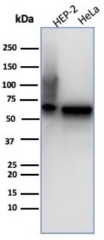 HSPD1 Antibody