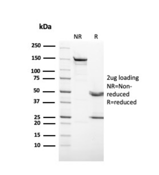 KRT3 Antibody