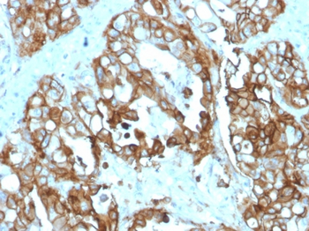TACSTD2 Antibody